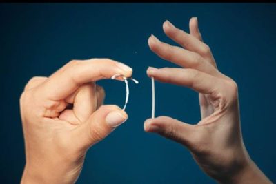 nexplanon-vs-iud